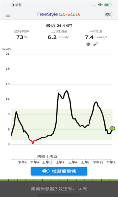 瞬感宝手机